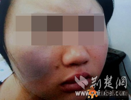 网曝湖北一教师暴打女生俩小时 网友:比土匪还凶