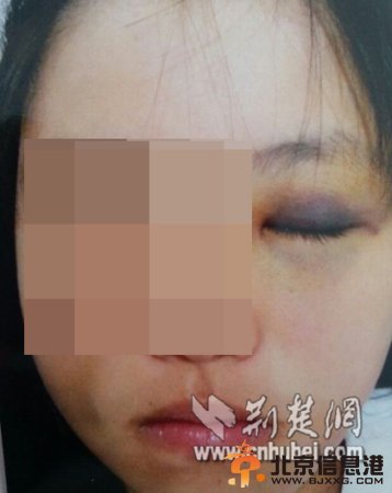 网曝湖北长阳教师打女生网友发帖:比土匪还凶（图）