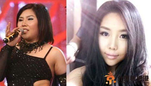 纪敏佳整容今昔对比照 颧骨磨平变锥脸女神(图)