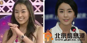 郑柔美个人资料简介及郑柔美整容前后对比照曝光