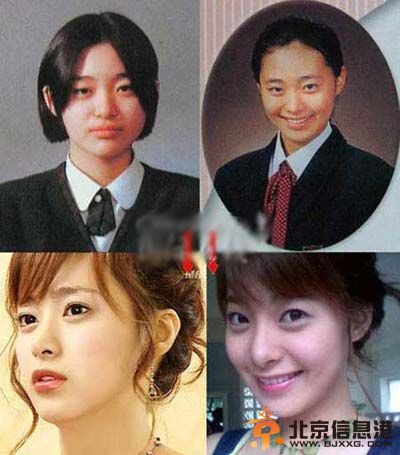 李英恩个人资料图片 演过的电视剧电影 李英恩整容前后对比照