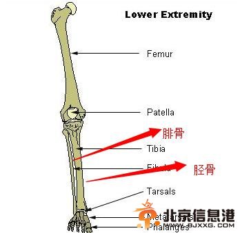 乔治胫骨腓骨开放性骨折 接受手术将植入钢钉