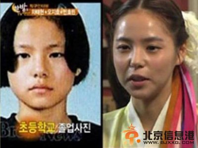 闵孝琳个人资料图片 演过的电影 闵孝琳整容前后照片对比