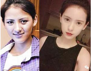 王思聪女友张予曦整容前后对比照曝光
