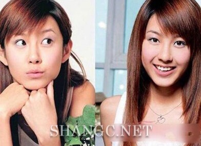 长大白晓菁是谁演的 白晓菁扮演者张子萱承认整容