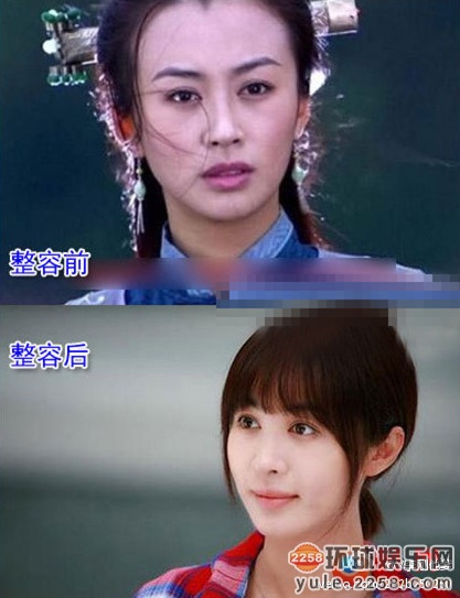 李易峰女友都爱整容 李菲儿整容前后对比照被扒