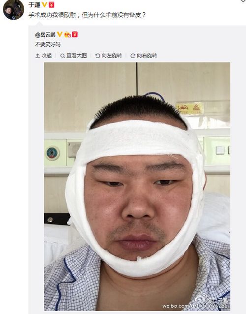 岳云鹏晒术后脸肿缠绷带照 坦言：不要笑好吗