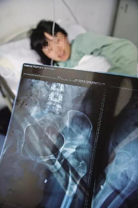 受伤护士躺病床上。