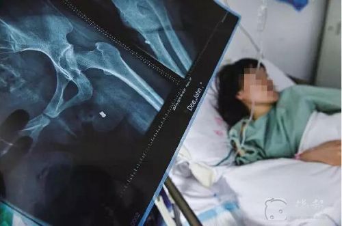 温州女子娘家阳台遭枪击 屁股中弹【图】