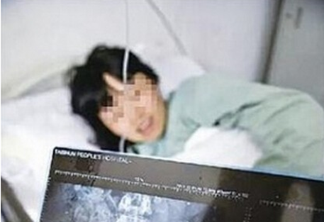 【附图】女子阳台遭枪击鲜血直喷极其恐怖 屁股不幸遭殃中弹深20厘米