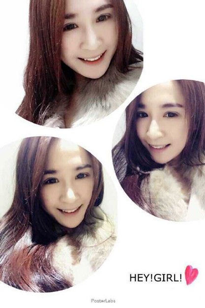 河南电视台美女主播被车撞 造成四肢多处粉碎性骨折